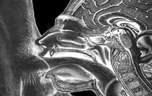 «Вафлизм» в подростковом возрасте - Автор Неизвестен